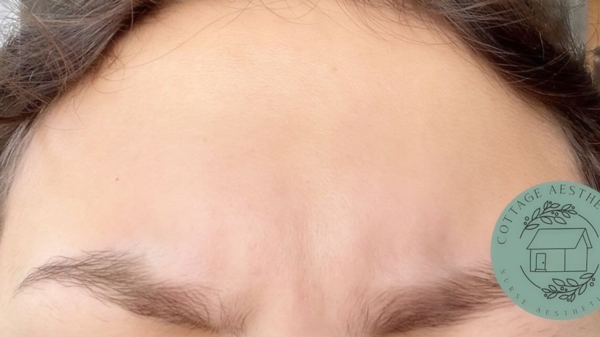 Brow &amp; Eye Area — after
